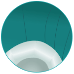  Removable cover