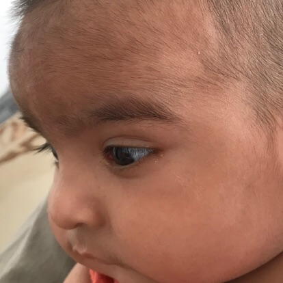My baby is 3 months and has a lot of hair on his forehead and face .Can i  do something about it? – FirstCry Parenting