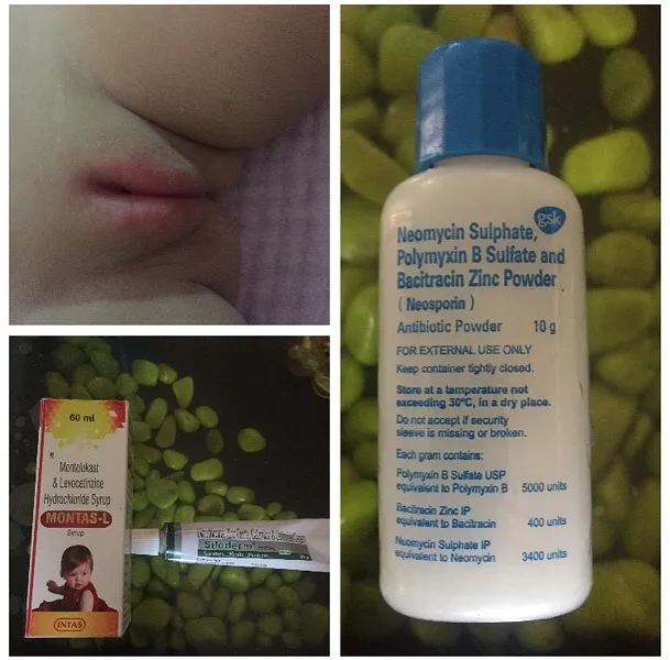 Siloderm ointment hot sale for baby