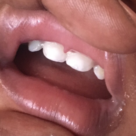 brushing 15 month old teeth