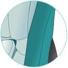 Removable cover