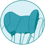 Lateral headrests