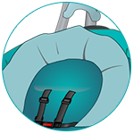 Removable Head Support