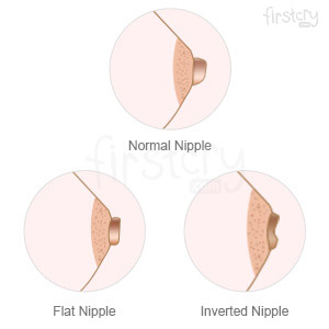 Nipple Types