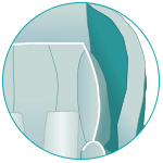  Protection from side impacts 