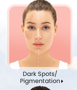 Dark Spots/Pigmentation