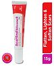 Mankind ScarEnd Silicone Gel for Scar Removal | Burn, Stretch, Acne, C Section, Post Surgery, Injury Scar or Marks | Lightens Old Scars | For All Skin Types | With Cyclomethicone and Ceramides |15 g