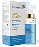 7 days Natural Acne Face Serum For Acne Breakouts - 30 ml