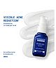 DERMDOC Kojic Acid Face Serum 2% for Dark Spots & Pigmentation Care- 20 ml